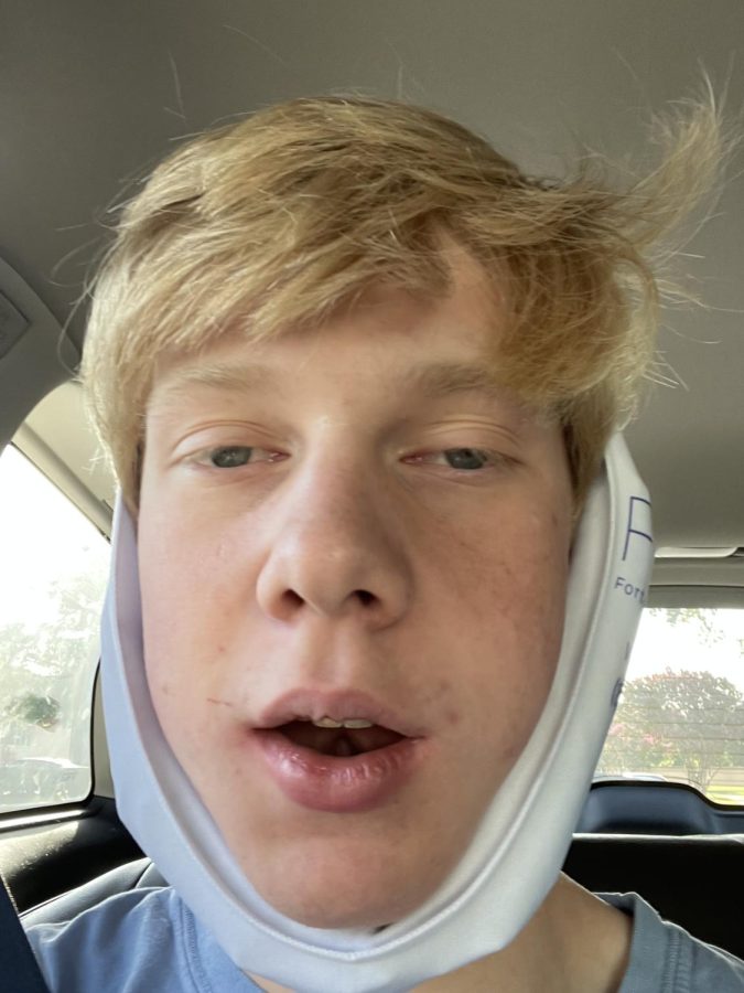 Marshall Lehman 24, moments after having his wisdom teeth excised.